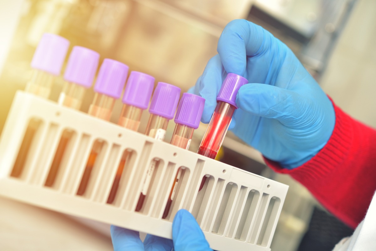 rack-with-test-tubes-of-blood-stock-image-colourbox